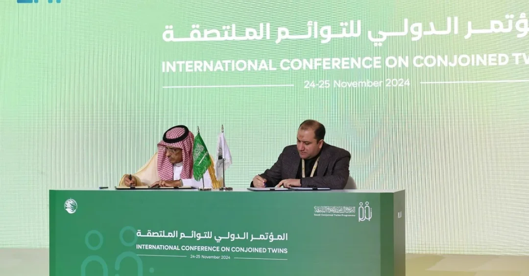 KSrelief Partners with IRVD to Support Separated Conjoined Twins